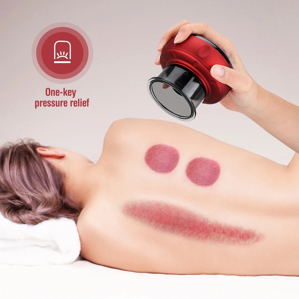 Revitalize Your Body with the Smart Electric Vacuum Cupping Device - Ultimate Fatigue Relief and Anti-Cellulite Massager!